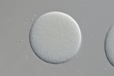 Fécondation chez  l'Oursin (Sphaerechinus granularis) x100